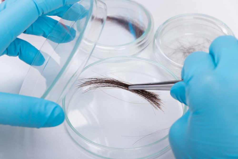Hair Sample DNA Test
